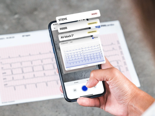 PMcardio: digitale ondersteuning van ECG-analyse en zorgworkflow